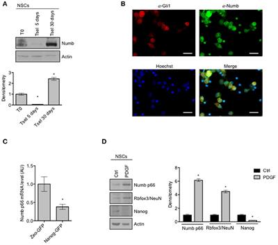 Numb Isoforms Deregulation in Medulloblastoma and Role of p66 Isoform in Cancer and Neural Stem Cells